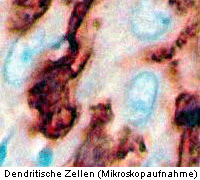 Dendritische Zellen unter dem Mikroskop